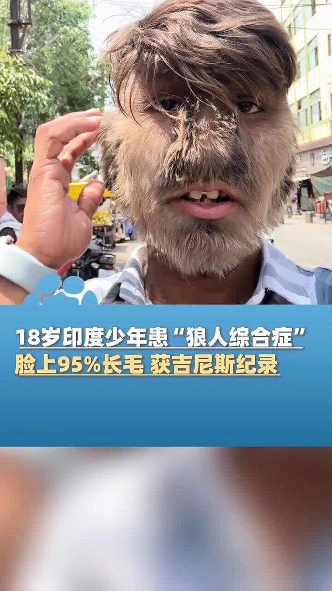 五月婷六月激情久久综合的相关介绍
